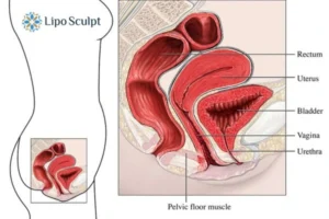 Treatment For A Leaky Bladder 2 How EM Chair treatment Walton can help Leaky bladder issues. Read more now!