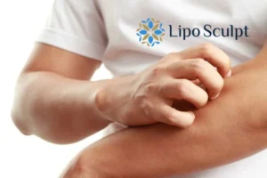 Best Actinic Keratoses Removal 4 prevent your actinic keratoses Walton getting worse - call our team today!