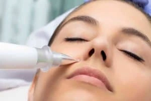 Best Actinic Keratoses Removal 3 Actinic keratoses Walton solutions - book in today!